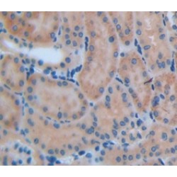 Matrix Metalloproteinase 13 (MMP13) Antibody