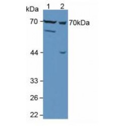 Matrix Metalloproteinase 13 (MMP13) Antibody