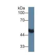 Western blot analysis of Rat Serum, using Rat MMP13 Antibody (1 µg/ml) and HRP-conjugated Goat Anti-Rabbit antibody (<a href="https://www.abbexa.com/index.php?route=product/search&amp;search=abx400043" target="_blank">abx400043</a>, 0.2 µg/ml).