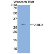 Western blot analysis of recombinant Human MMP24.