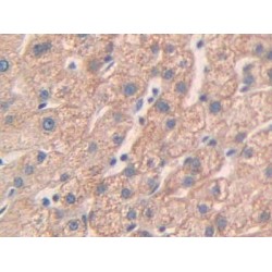 Matrix Metalloproteinase 24 (MMP24) Antibody