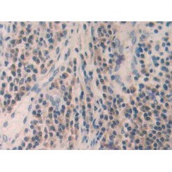 Matrix Metalloproteinase 24 (MMP24) Antibody
