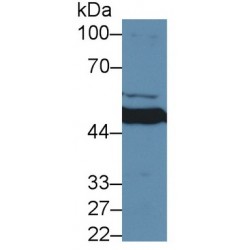 Matrix Metalloproteinase 24 (MMP24) Antibody