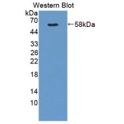 Western blot analysis of the recombinant protein.