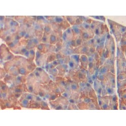 Myosin Light Chain Kinase 4 (MYLK4) Antibody