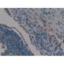 Neutrophil Specific Antigen 1 (NB1) Antibody