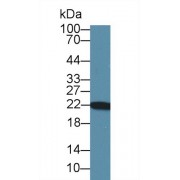 Western blot analysis of Rat Heart lysate, using Rat PARK7 Antibody (1 µg/ml) and HRP-conjugated Goat Anti-Rabbit antibody (<a href="https://www.abbexa.com/index.php?route=product/search&amp;search=abx400043" target="_blank">abx400043</a>, 0.2 µg/ml).