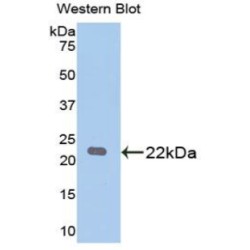 Parkinson Disease Protein 7 (PARK7) Antibody