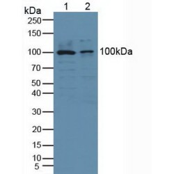 Cytosolic Phospholipase A2 (PLA2G4A) Antibody