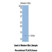 Western blot analysis of the recombinant protein.