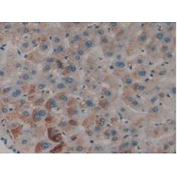 Plasminogen Activator, Tissue (tPA) Antibody