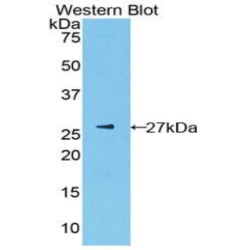 Pyruvate Kinase, Liver And RBC (PK) Antibody