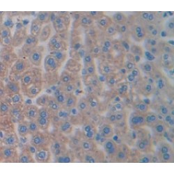 Pyruvate Kinase, Liver And RBC (PK) Antibody