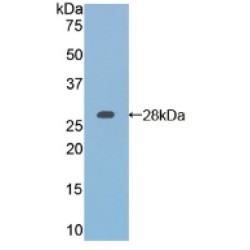 Retinoic Acid Receptor Alpha (RARa) Antibody