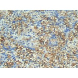 S100A1 Calcium Binding Protein (S100A1) Antibody