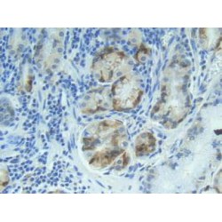 S100A1 Calcium Binding Protein (S100A1) Antibody