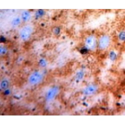 S100A1 Calcium Binding Protein (S100A1) Antibody