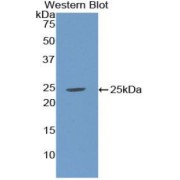 Western blot analysis of the recombinant protein.