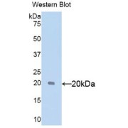 Western blot analysis of the recombinant protein.