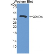 Western blot analysis of the recombinant protein.