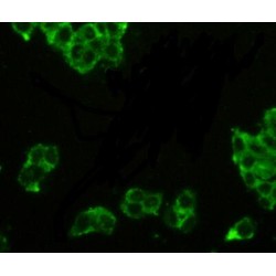 Prostatic Acid Phosphatase (ACP3) Antibody