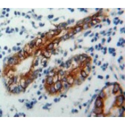 Antigen-Presenting Glycoprotein CD1d (CD1D) Antibody