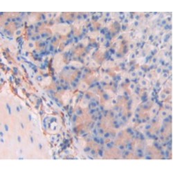 Hematopoietic Progenitor Cell Antigen CD34 (CD34) Antibody