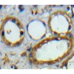 Cluster of Differentiation 3d (CD3D) Antibody