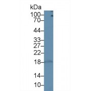 Western blot analysis of Rat Lymph node lysate, using Rat CD3d Antibody (1 µg/ml) and HRP-conjugated Goat Anti-Rabbit antibody (<a href="https://www.abbexa.com/index.php?route=product/search&amp;search=abx400043" target="_blank">abx400043</a>, 0.2 µg/ml).