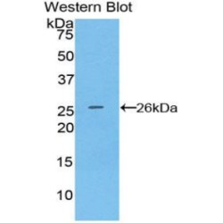 B-Cell Differentiation Antigen CD72 (CD72) Antibody