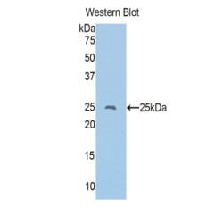 T-Cell Surface Glycoprotein CD8 Alpha Chain (CD8A) Antibody