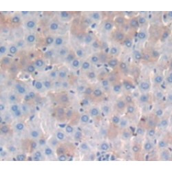 T-Cell Surface Glycoprotein CD8 Alpha Chain (CD8A) Antibody