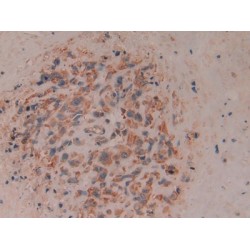 T-Cell Surface Glycoprotein CD8 Beta Chain (CD8B) Antibody