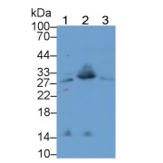 Western blot analysis of Rat Thymus (Lane 1), Mouse Lung (Lane 2), Mouse Thymus (Lane 3) lysates, using using T-Cell Surface Glycoprotein CD8 Beta Chain Antibody (3 µg/ml) and HRP-conjugated Goat Anti-Rabbit antibody (<a href="https://www.abbexa.com/index.php?route=product/search&amp;search=abx400043" target="_blank">abx400043</a>, 0.2 µg/ml).