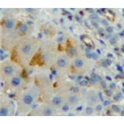 T-Cell Surface Glycoprotein CD8 Beta Chain (CD8B) Antibody