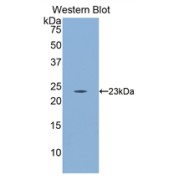 Western blot analysis of the recombinant protein.