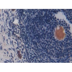 T-Cell Surface Glycoprotein CD8 Beta Chain (CD8B) Antibody