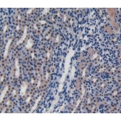 T-Cell Surface Glycoprotein CD8 Beta Chain (CD8B) Antibody