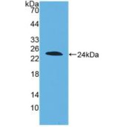 Disrupted In Schizophrenia 1 (DISC1) Antibody