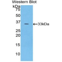 Glycogen Phosphorylase, Brain (PYGB) Antibody