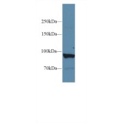 Western blot analysis of Human Liver lysate, using Human PYGL Antibody (1 µg/ml) and HRP-conjugated Goat Anti-Rabbit antibody (<a href="https://www.abbexa.com/index.php?route=product/search&amp;search=abx400043" target="_blank">abx400043</a>, 0.2 µg/ml).