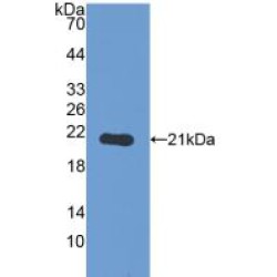 Glycogen Phosphorylase, Liver (PYGL) Antibody