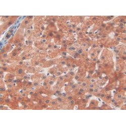 Glycogen Phosphorylase, Liver (PYGL) Antibody