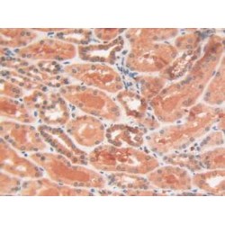 Glycogen Phosphorylase, Liver (PYGL) Antibody