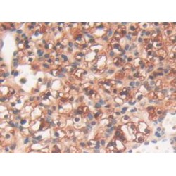 Glycogen Phosphorylase, Liver (PYGL) Antibody