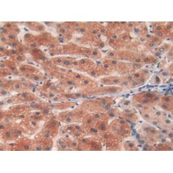 Glycogen Phosphorylase, Liver (PYGL) Antibody