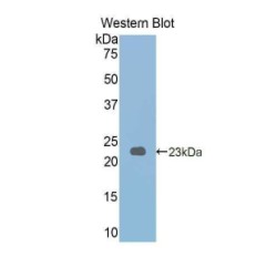 Glycogen Phosphorylase, Liver (PYGL) Antibody