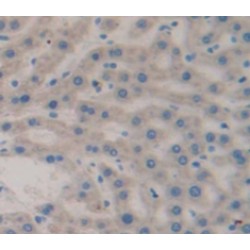 Glycogen Phosphorylase, Liver (PYGL) Antibody