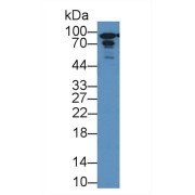 Western blot analysis of Mouse Cerebrum lysate, using Rat PYGL Antibody (2 µg/ml) and HRP-conjugated Goat Anti-Rabbit antibody (<a href="https://www.abbexa.com/index.php?route=product/search&amp;search=abx400043" target="_blank">abx400043</a>, 0.2 µg/ml).