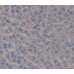 Glycogen Phosphorylase, Liver (PYGL) Antibody